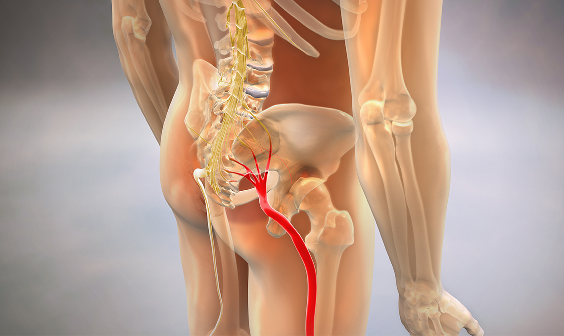 sciatica nerve treatment